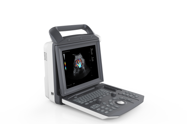 MÁY SIÊU ÂM DOPPLER XÁCH TAY V1EXP